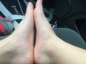 Swollen Left Foot